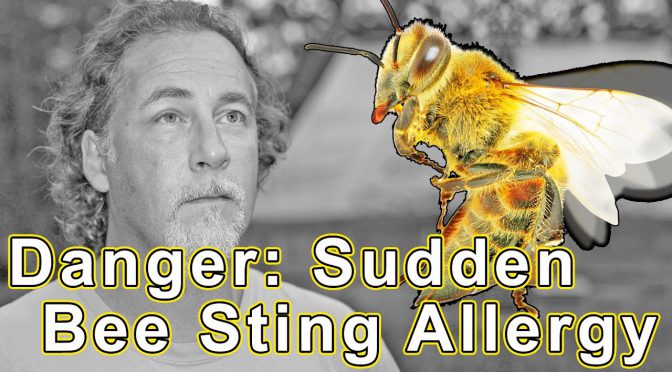Video: When SHTF – Sudden Onset Allergy – The Signs, Symptoms, and Dangers of Anaphylaxis