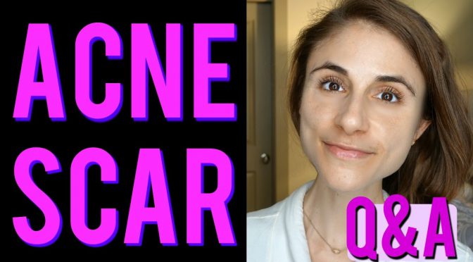 Video: ACNE SCAR Q&A: laser peels, microneedling, creams, silicone. ?
