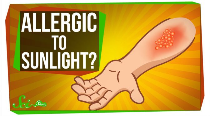 Video: Can You Be Allergic To Sunlight?
